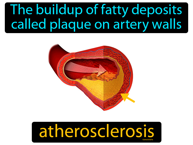 Atherosclerosis Definition