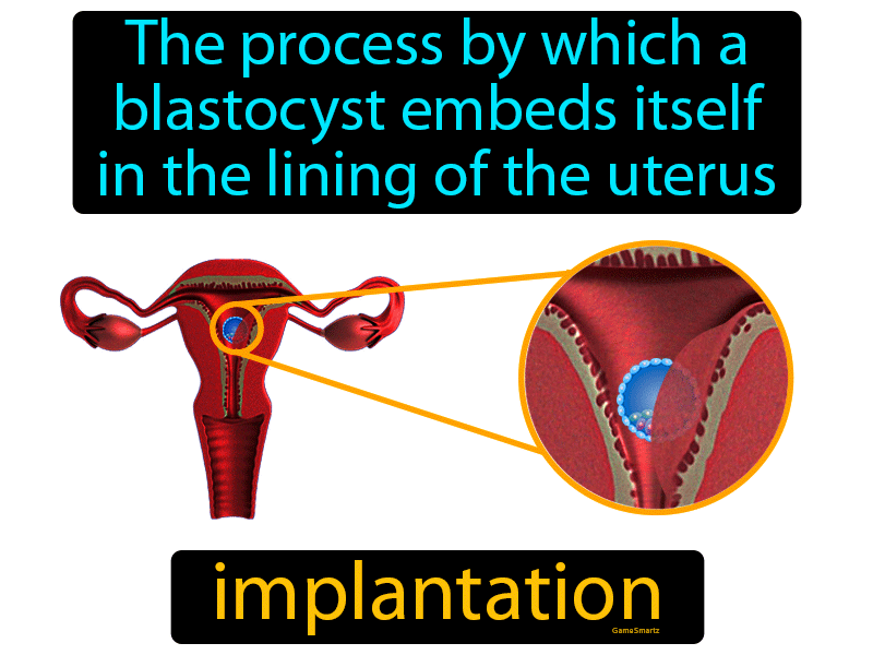 Implantation Definition