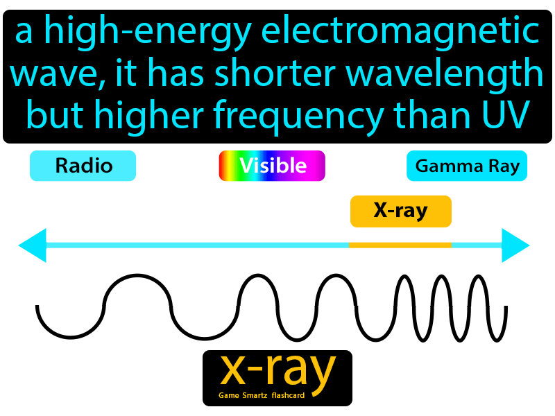 X-ray Definition