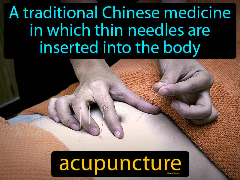 Acupuncture Definition
