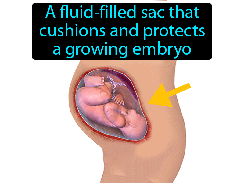 Amniotic Sac Definition with no text