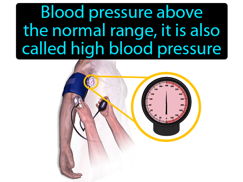 Hypertension Definition with no text