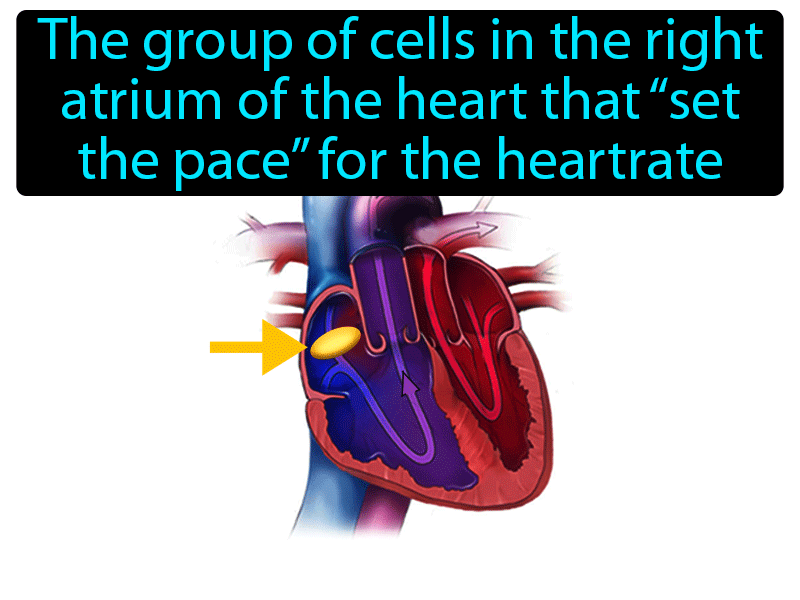 Pacemaker Definition with no text