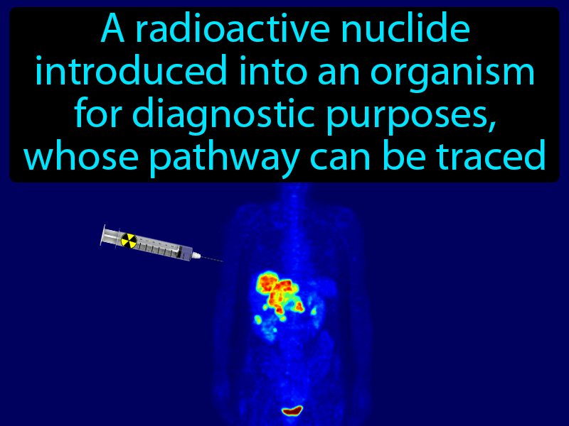 Radiotracer Definition with no text