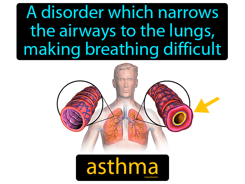 Asthma Definition