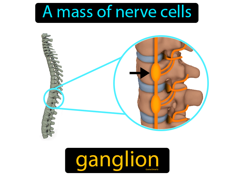 Ganglion Definition
