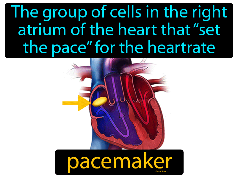 Pacemaker Definition